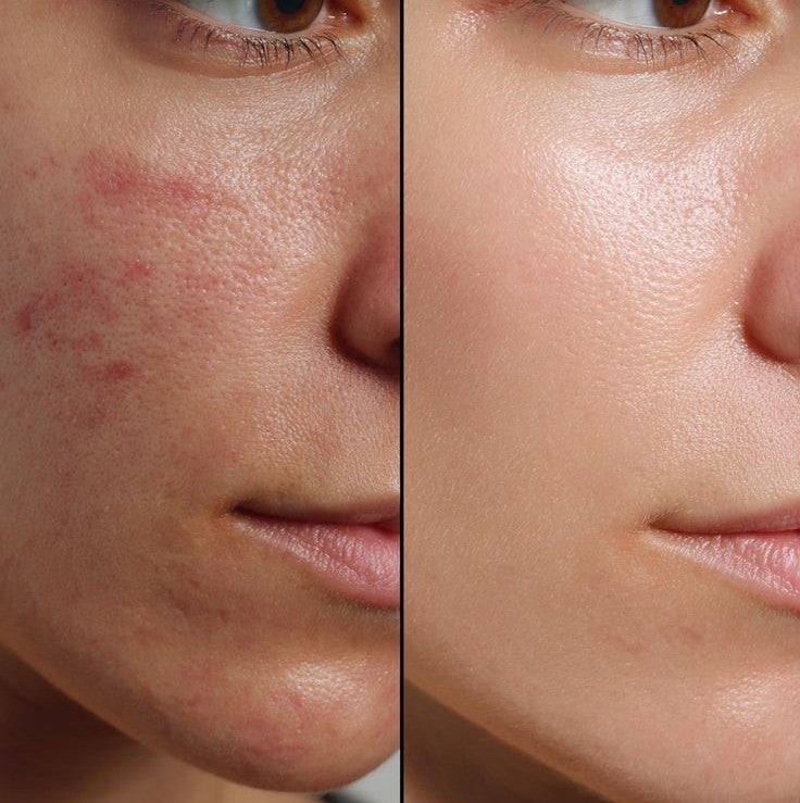 6 Reasons Your Skin Needs Extra Care Daily